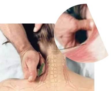 Myofascial Release2 (1)